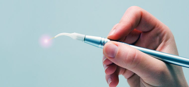 Cura Parodontite con Laser