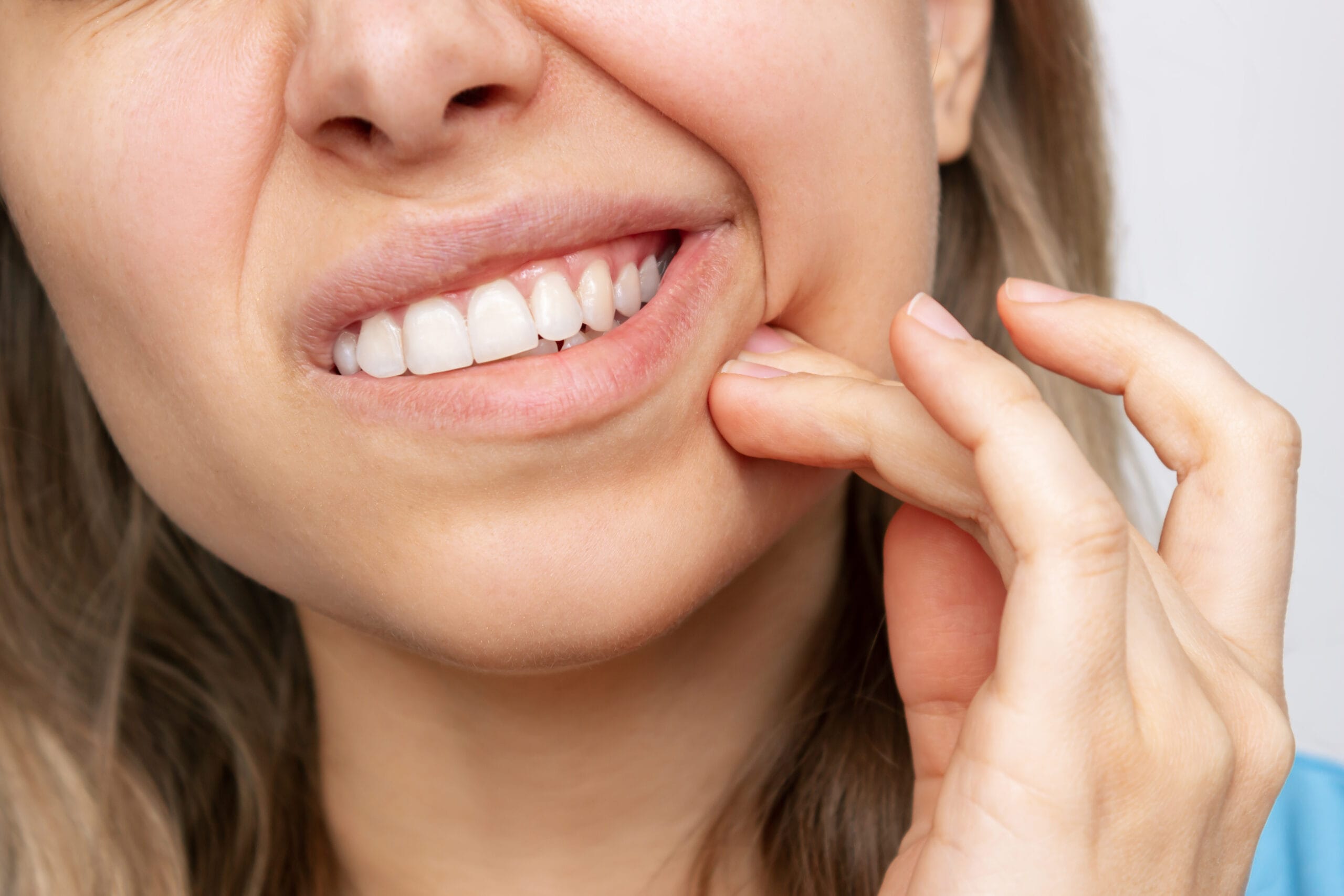 Gengive ritirate con recessione gengivale, denti più lunghi e sensibilità dentale al freddo